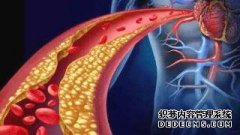 医生：当这五种异常出现在体内时，这