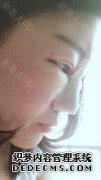 当一个女孩年轻时，她的鼻子是鼻子形