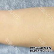 [有没有办法刮它？