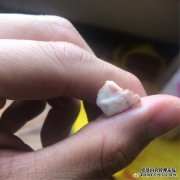 “您能要求孩子患有肝母细胞瘤还是有