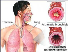 为什么我的喉咙总是有缺陷？