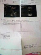 早孕是什么意思？