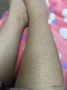 小牛毛孔粗大