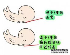 如何检查nt