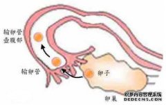 如何治疗输卵管变形