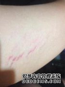 垂死的感觉是什么？
