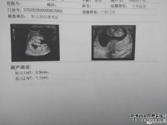 [nt确认方法