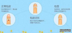 包皮每天都有很多污垢。