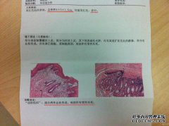 你的治疗方法是什么？